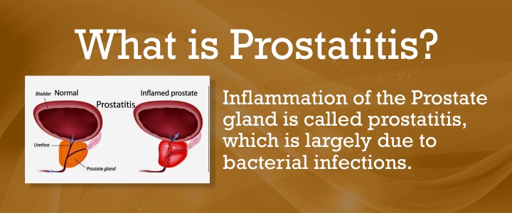 Treatment for Prostatitis